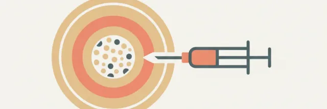 A simplified syringe and bone cross-section rendered in muted warm tones, flat vector illustration.