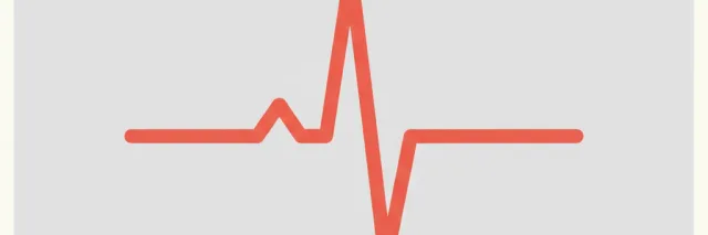 An ECG heartbeat trace on a pale background, flat vector editorial illustration.