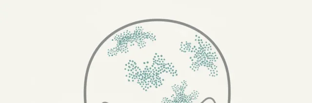 A flat vector illustration of a stylized scalp outline with small abstract graft markers, muted teal and grey tones.